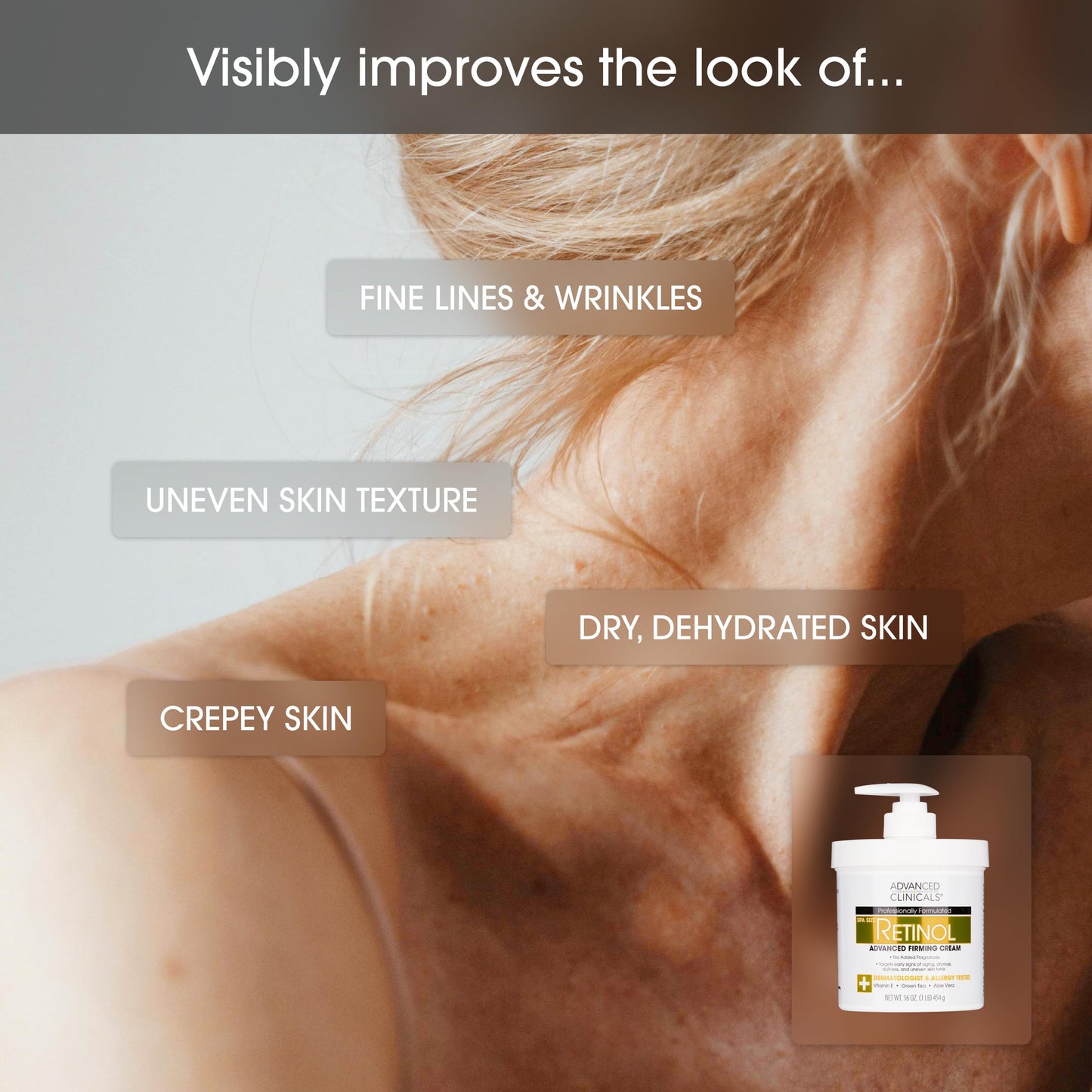Advanced Clinicals Hyaluronic Acid Moisturizer Body Cream W/Vitamin E | Hydrating Cream & Body Lotion For Women & Men To Help Improve Look of Wrinkles, Dry Skin, Crepey Looking Skin, 16 Ounce